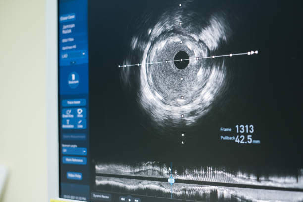 揭秘泰国能做试管婴儿的医院 揭秘泰国能做试管婴儿的医院